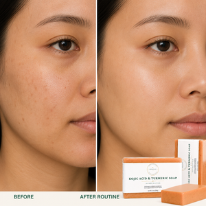 Kojic Acid & Turmeric Soap